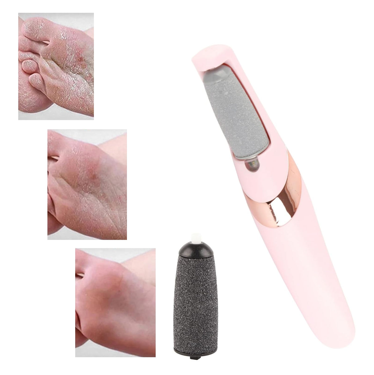 Foot Fix™ | Lima Eléctrica Anti Callos