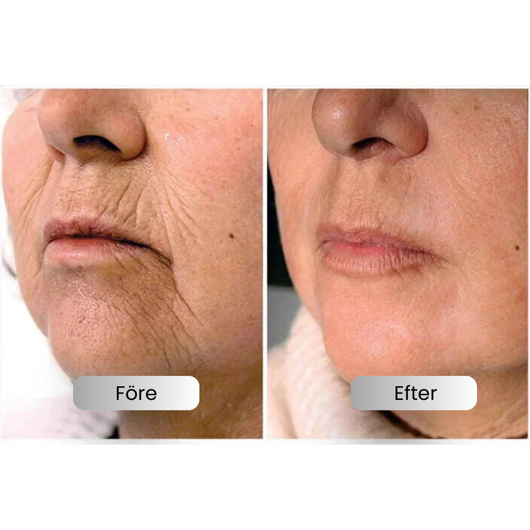 SkinLift™ | Serúm Efecto Botox