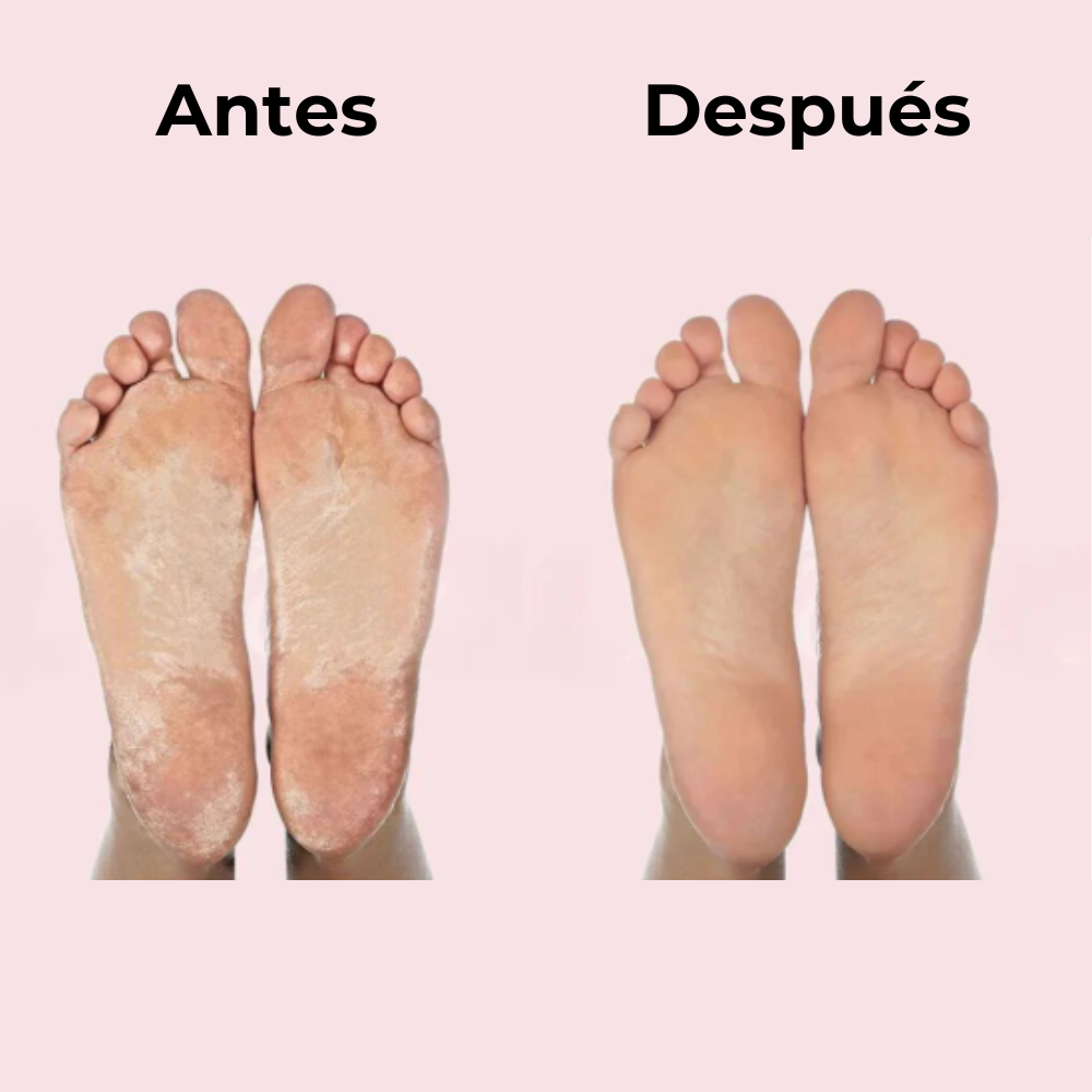 Foot Fix™ | Lima Eléctrica Anti Callos