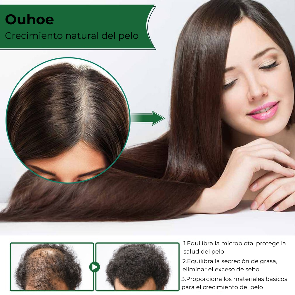 Ouhoe™ | Aceite natural para el crecimiento del cabello